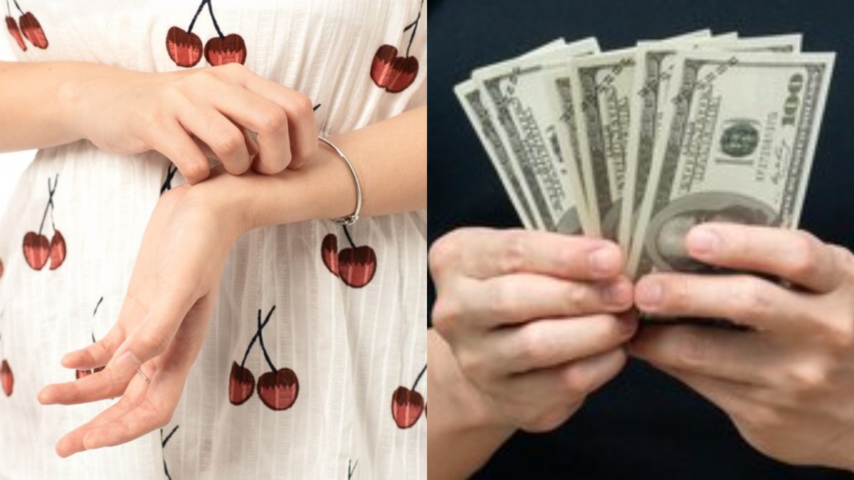 Svrbež lijevog dlana znači - novac ili loša sreća?